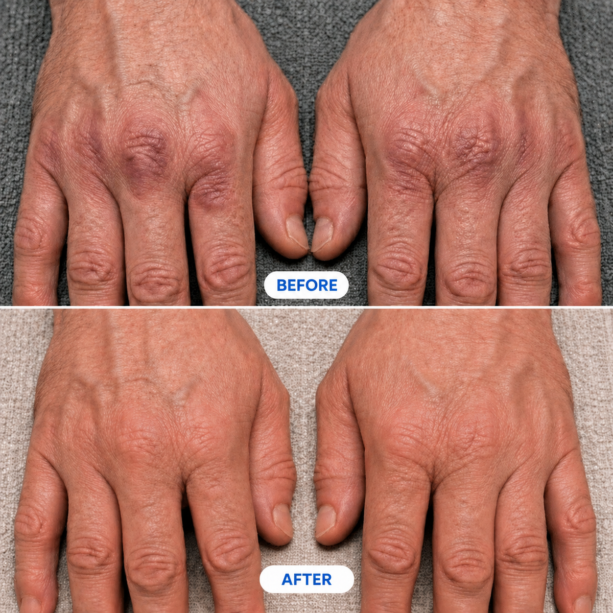 Therapeutic Hand and Wrist Massager