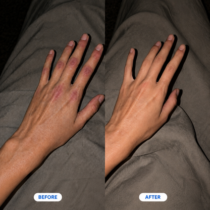 Therapeutic Hand and Wrist Massager